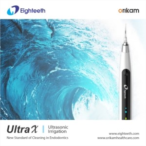UltraX Ultrasonic Irrigation