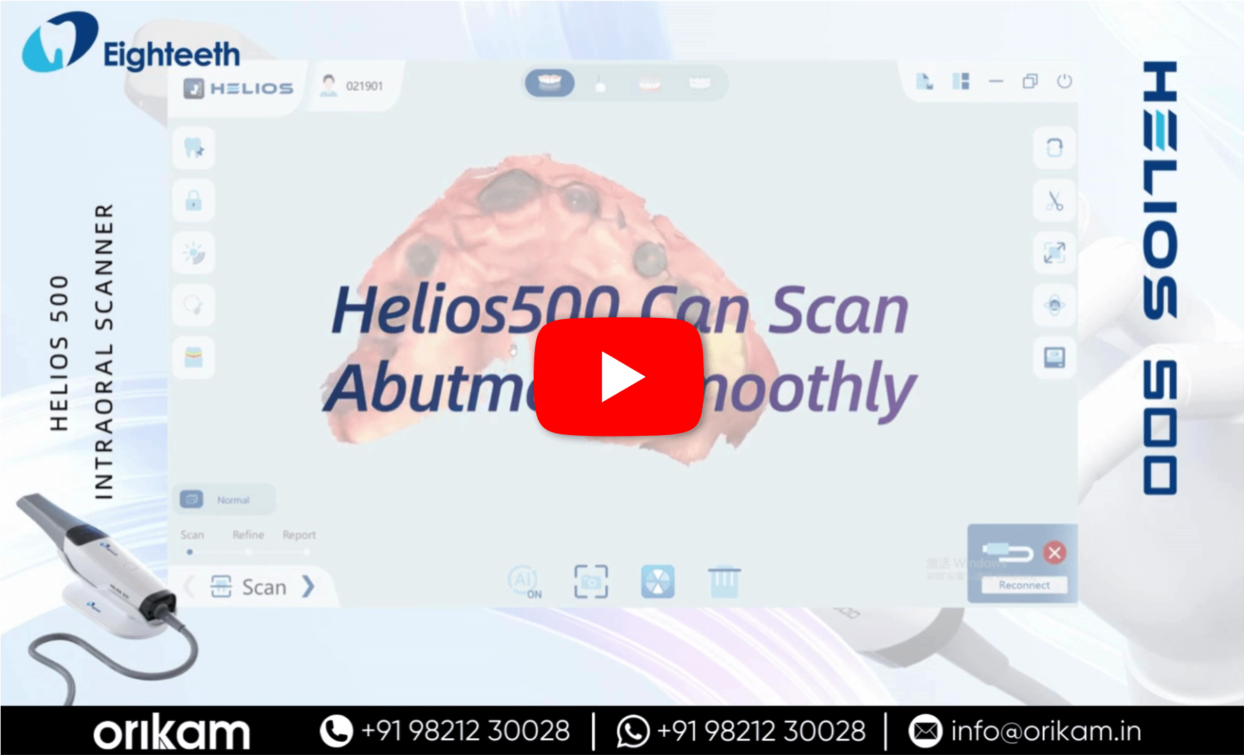 Can Helios 500 Scan Abutment