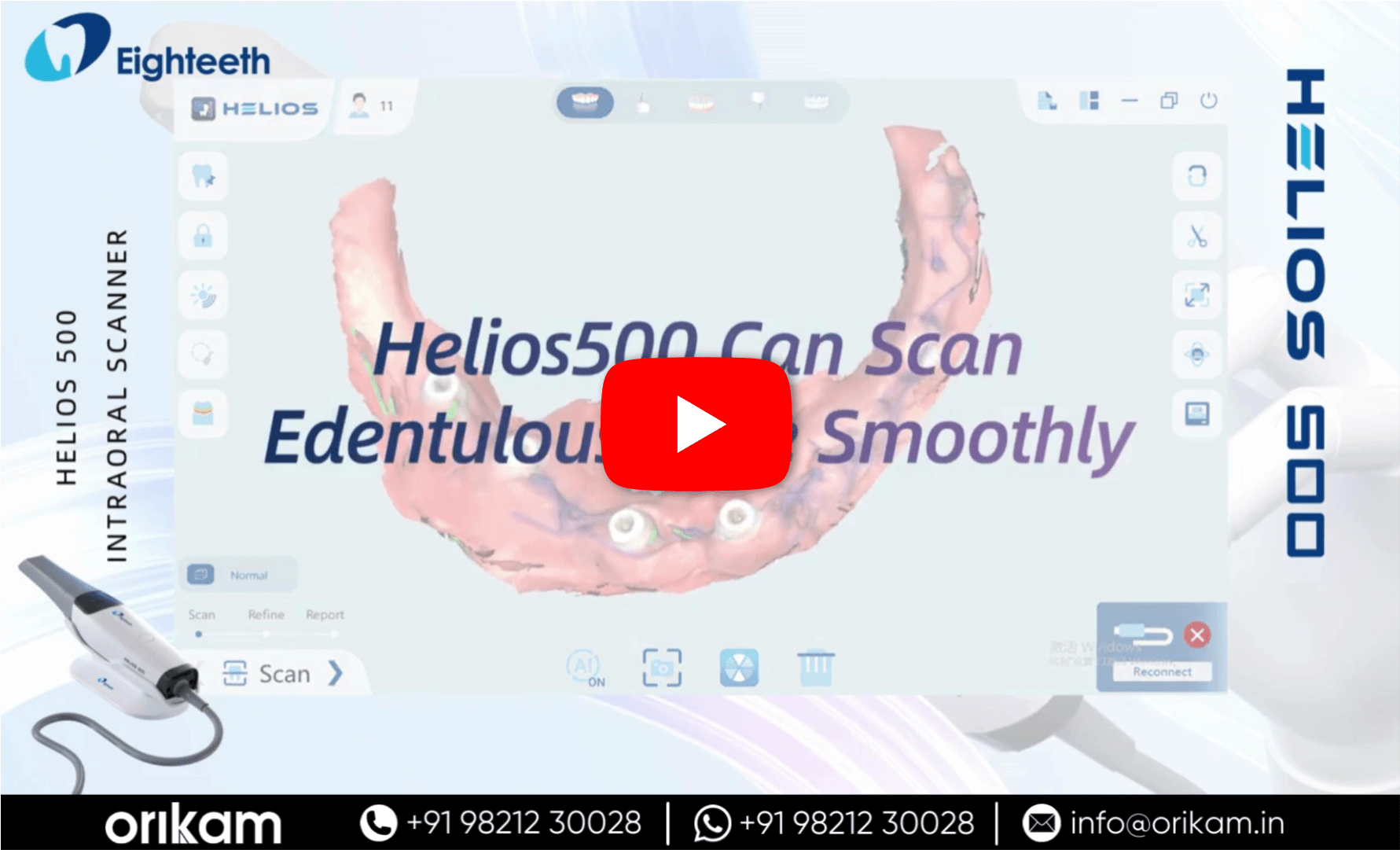 Can Helios 500 Scan Edentulous Case