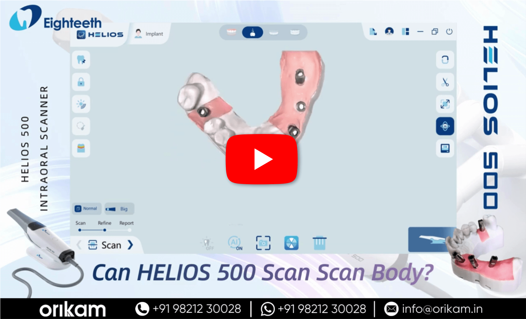 Can Helios 500 Scan Scan Body